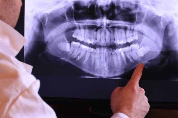 Best Emergency Dentist for Knocked-Out Tooth in Sunbury, PA