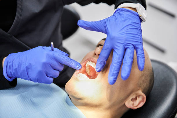 Best Emergency Dentist for Knocked-Out Tooth in Sunbury, PA